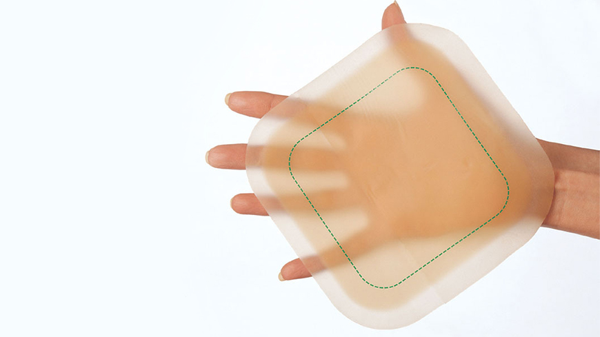 상처 드레싱을 들고 있는 손