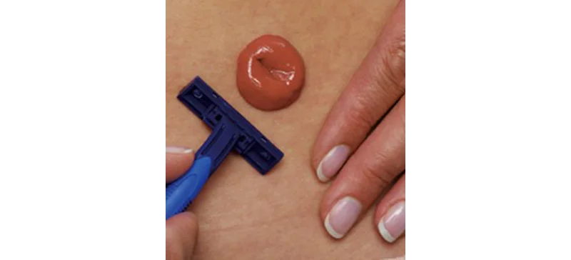 Die sechs Schritte des Versorgungswechsels –  Schritt 4 Bild