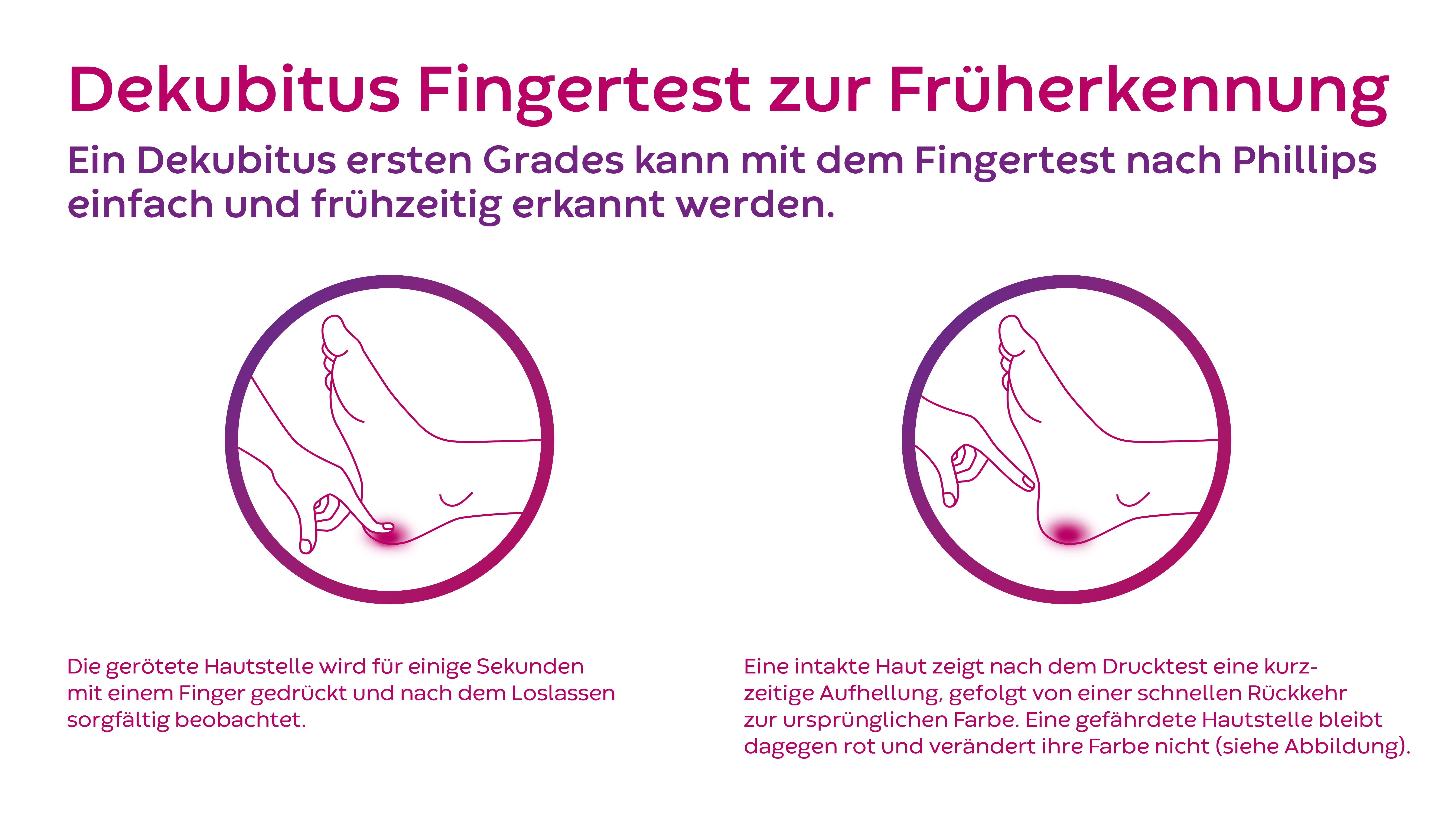 Dekubitus Test zur Früherkennung nach Philips